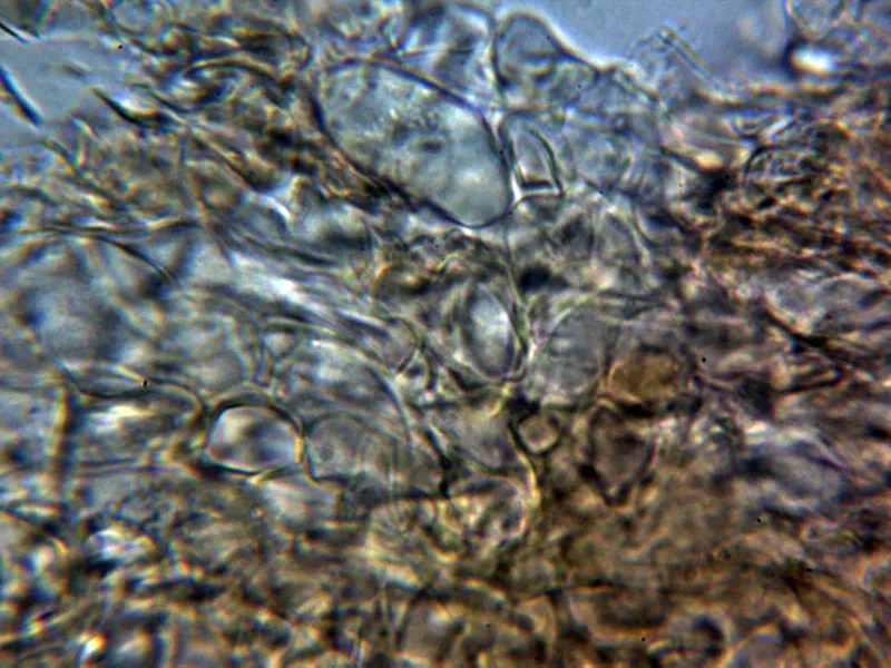 Armillaria ostoyae 10 - Suprapellis agua 1